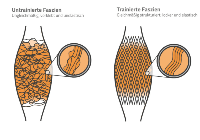 Bild zum Blogthema Faszien